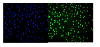Anti-Cbx8 Antibody