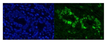 Anti-Cbx8 Antibody