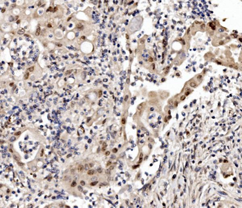 Anti-Cbx8 Antibody