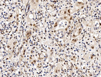 Anti-Cbx8 Antibody