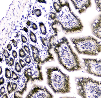 Anti-Cbx8 Antibody