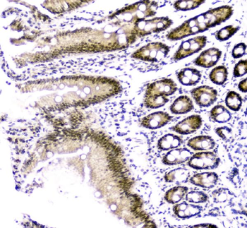 Anti-Cbx8 Antibody