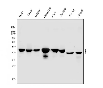 Anti-Cbx8 Antibody