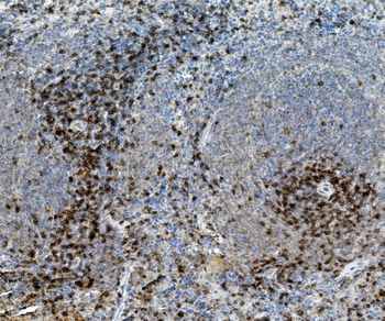 Anti-CD8 alpha/Cd8a Antibody