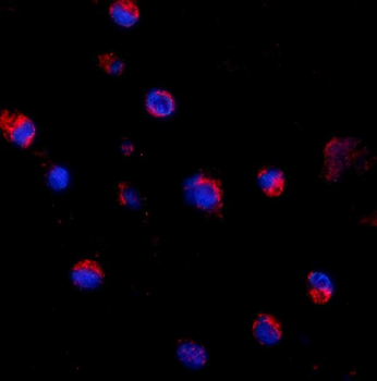 Anti-CD69 Antibody