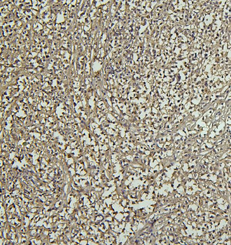 Anti-CD69 Antibody
