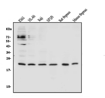 Anti-CD69 Antibody