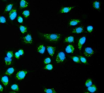 Anti-CLPB Antibody
