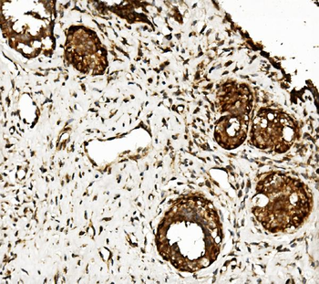 Anti-CLPB Antibody