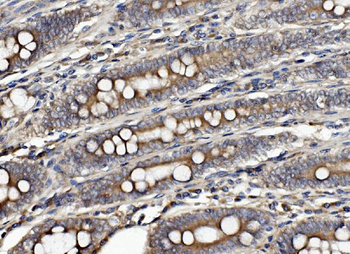 Anti-CLPB Antibody