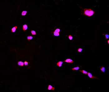 Anti-CTHRC1 Antibody