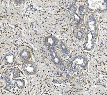 Anti-CTHRC1 Antibody