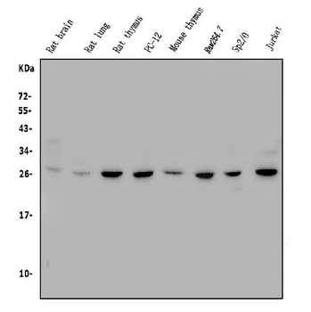 Anti-CTHRC1 Antibody