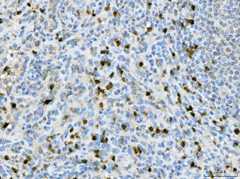 Anti-CXCR2 Antibody