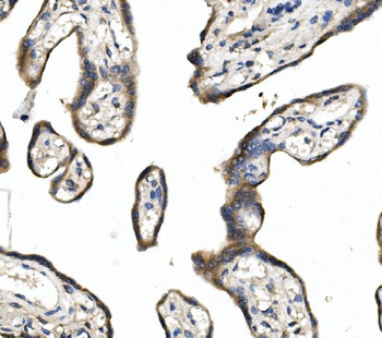 Anti-DLL1 Antibody