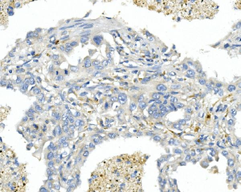 Anti-Endothelin A Receptor/ET-A/EDNRA Antibody