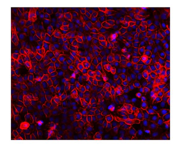 Anti-EGFR Antibody