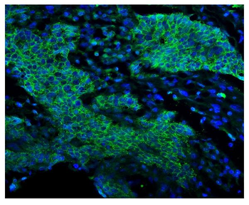 Anti-EGFR Antibody