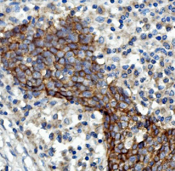 Anti-EGFR Antibody
