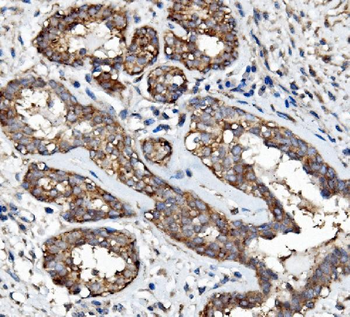 Anti-EGFR Antibody