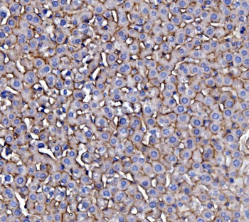 Anti-EGFR Antibody