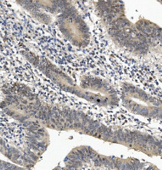 Anti-EYA4 Antibody