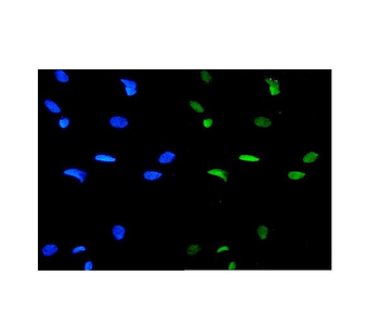 Anti-GATA3 Antibody