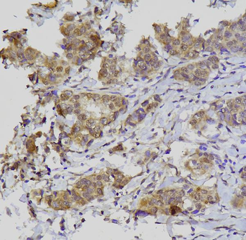 Anti-GATA3 Antibody