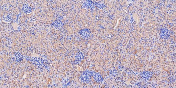 Anti-Glutaminase/GLS Antibody