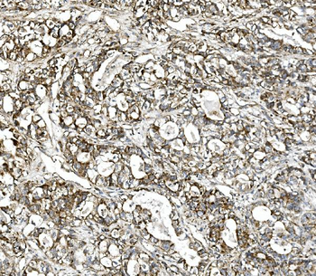 Anti-Glutaminase/GLS Antibody