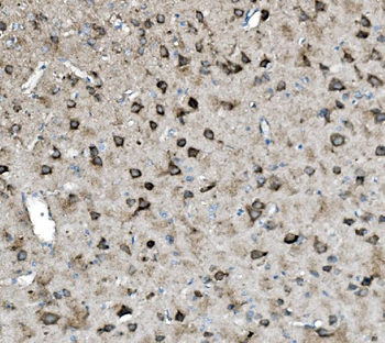 Anti-Glutaminase/GLS Antibody