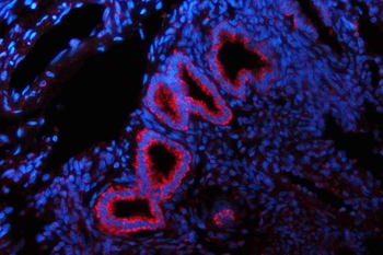 Anti-Glutaminase/GLS Antibody