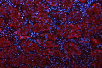Anti-Glutaminase/GLS Antibody