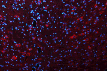 Anti-Glutaminase/GLS Antibody