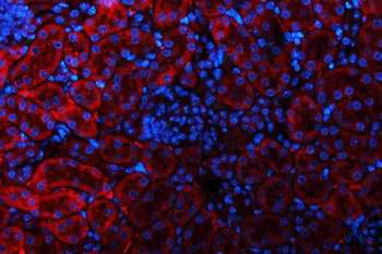 Anti-Glutaminase/GLS Antibody
