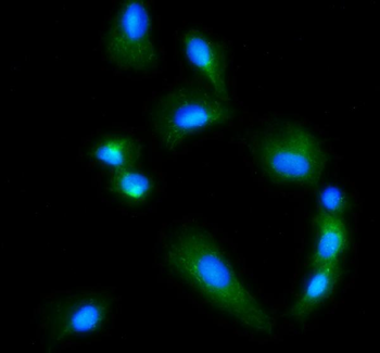 Anti-Glutaminase/GLS Antibody