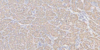 Anti-Glutaminase/GLS Antibody