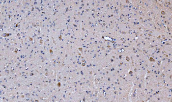 Anti-Glutaminase/GLS Antibody