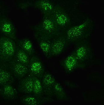 Anti-Glypican 5/GPC5 Antibody