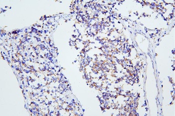 mGluR1/GRM1 Antibody