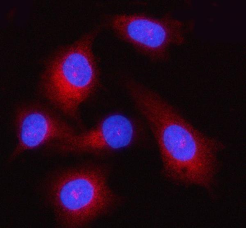 Anti-GSDMD Antibody