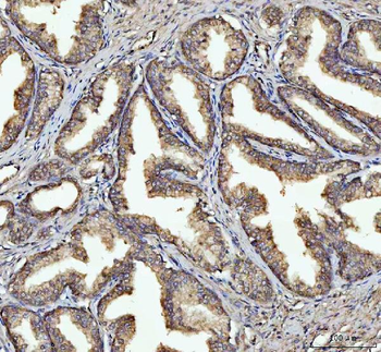 Anti-GSDMD Antibody