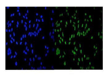 HDAC9 Antibody