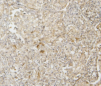 Anti-IRF3 Antibody
