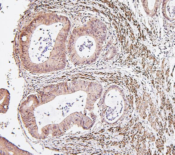 Anti-IRF3 Antibody