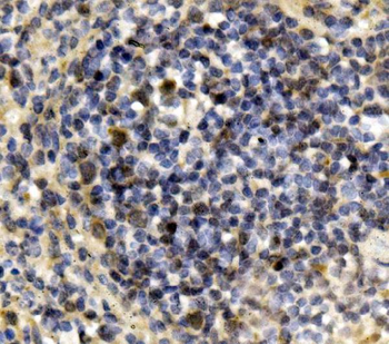 Anti-IRF3 Antibody