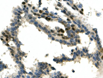Anti-ITCH/AIP4 Antibody