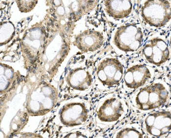 Anti-ITCH/AIP4 Antibody
