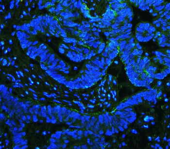 Anti-Integrin beta 4/ITGB4 Antibody