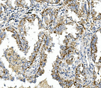 Anti-Integrin beta 4/ITGB4 Antibody